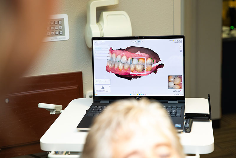 3d scan of Patient teeth