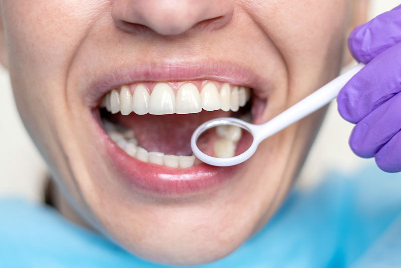 Doctor looking into Patients mouth