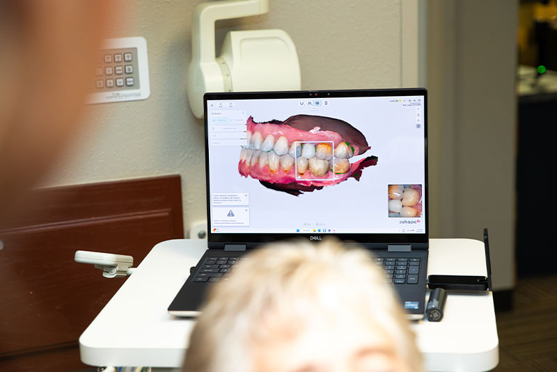 3d scan of Patients teeth