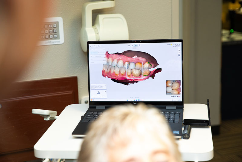 3d scan of Patients teeth