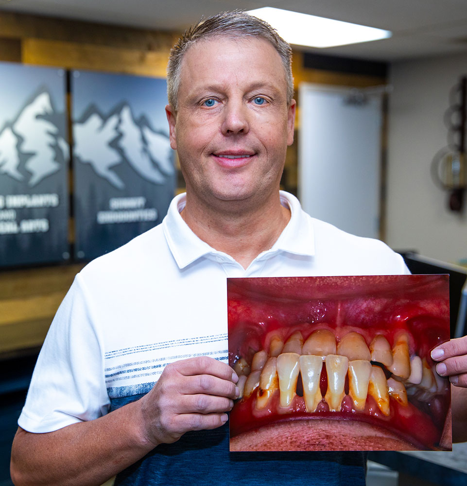 man holding a before and after photo of his teeth